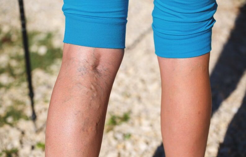 Beheko muturretan kalteak