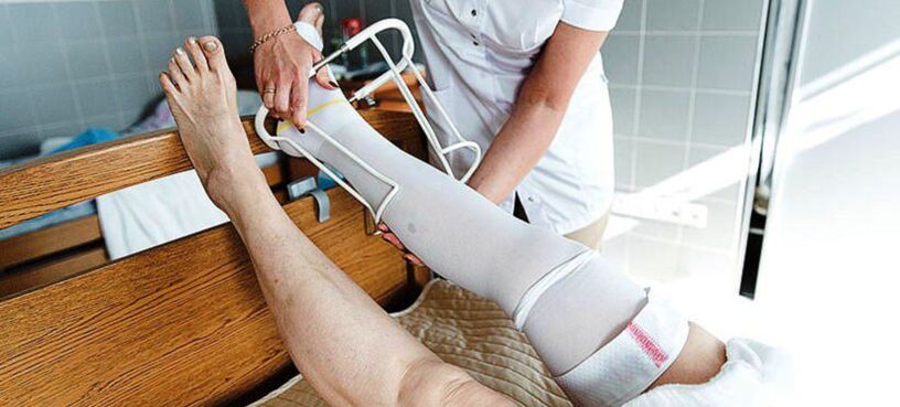 konpresio galtzerdiak barizeak tratatzeko